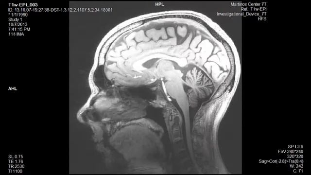 MRI 10 07 2013