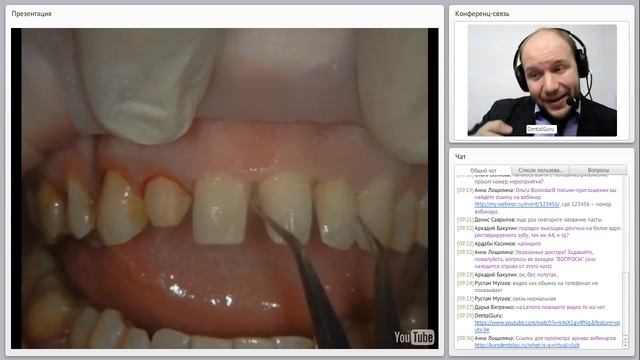 03. 2017 01 31  Особенности реставрации зубов со скученностью  Как работать без силиконового ключа