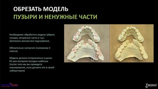 10. 2018 05 22  СЕДОВ Ю    Применение современных трехмерных методов диагностики на этапе планирован