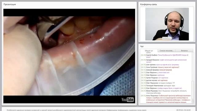 01. 2017 01 17  Особенности удаления моляров на верхней и нижней челюсти, одномоментная имплантация