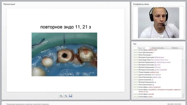 25. 2016 09 13  Применение микроскопа в практике стоматолога терапевта  822440