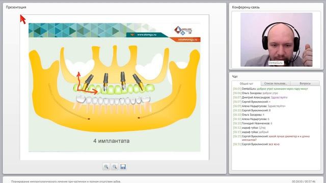 07. 2016 04 05  Планирование имплантологического лечения при частичном и полном отсутствии зубов  73
