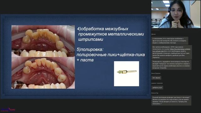 30. ''Принципы алгоритма при проведении профессиональной гигиены.''(13.08.2019)