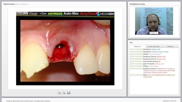 04. 2013 10 22 Секреты одномоментной имплантации и немедленная нагрузка  0001