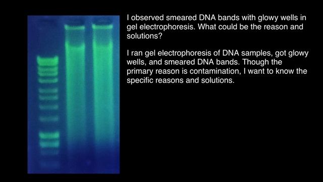 This Is Why Gel Electrophoresis May Get Smeared DNA Bands