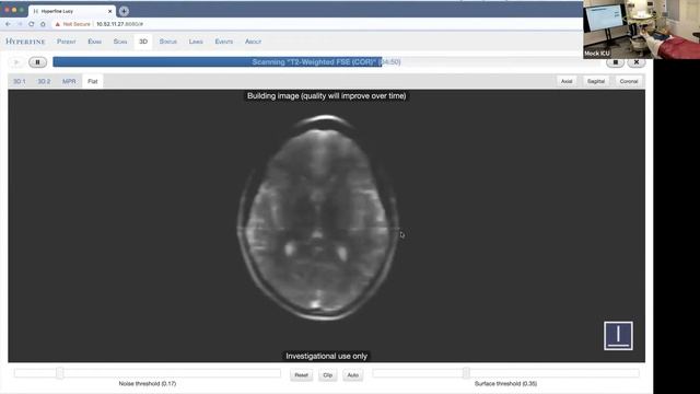 DEMO: Hyperfine Portable MRI