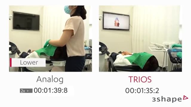 Analog VS. Digital ก้าวสู่ทันตกรรมดิจิตอลกับ 3Shape Trios - Intraoral Scanner