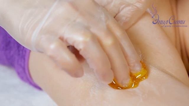 Шугаринг. Эпиляция сахаром. Салон ЭпилСити