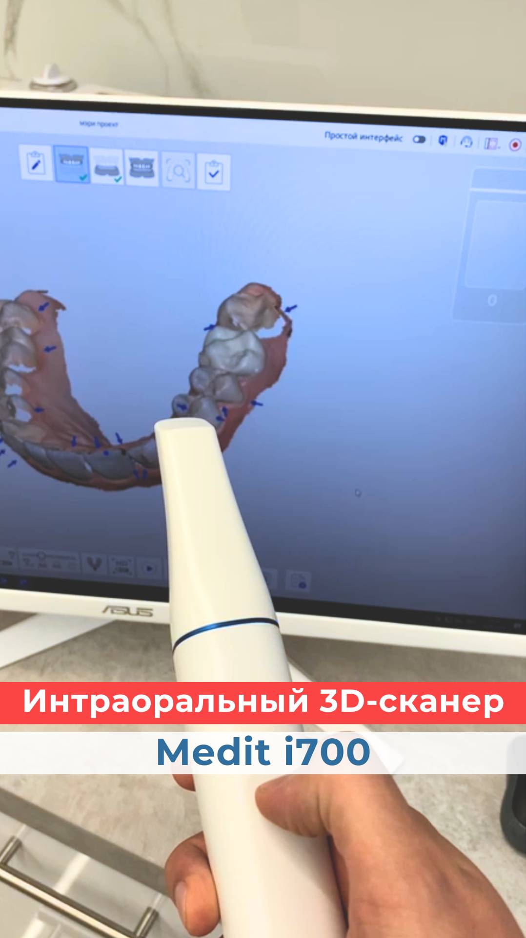 Medit i900 — 3D сканер премиум-класса