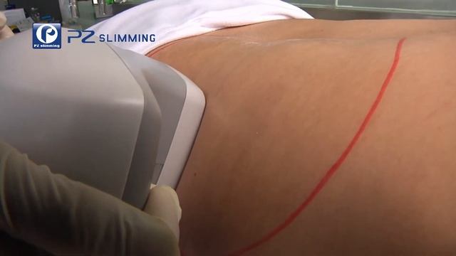 Valeshape slimming machine PZ LASER produced for body slimming & face lifting