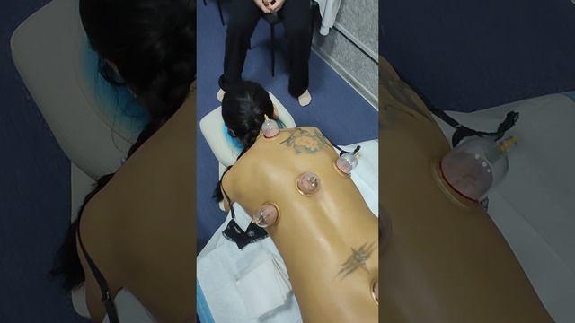 хиджама после правки позвоночника #массаж