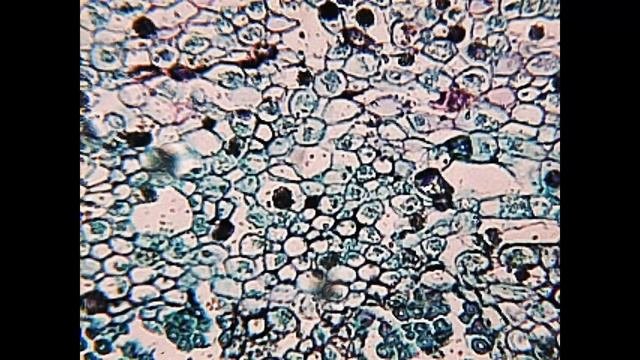 Stem Of Cotton Under Microscope - Bresser Biolux LCD