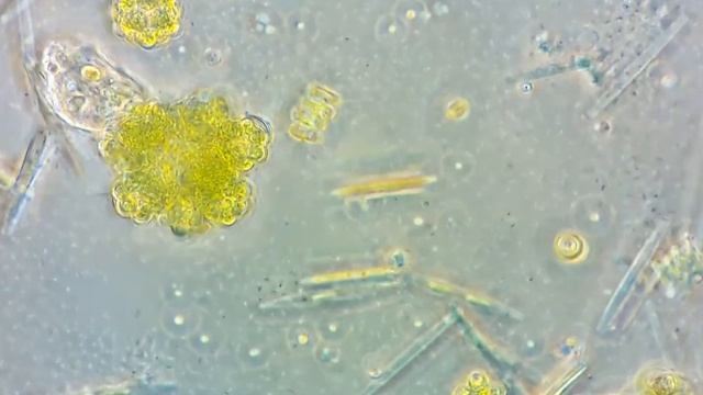 Разные микроскопические водоросли. 1000х \ Various microscopic algae. 1000x