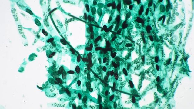 Conjugation of Spirogyra whole mount under microscope 100x against bright field