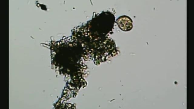 Celestron Pentaview - Standing water microbes, Ew!