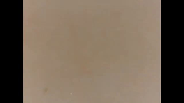 PARTES DO CORPO NO MICROSCÓPIO 1000× !!