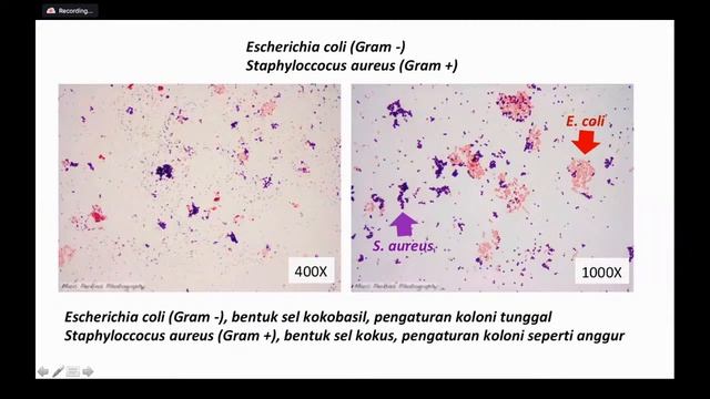 WORKSHOP PENDALAMAN BIOLOGI SERI 2, Pengamatan Sel Bakteri Melalui Pewarnaan Gram
