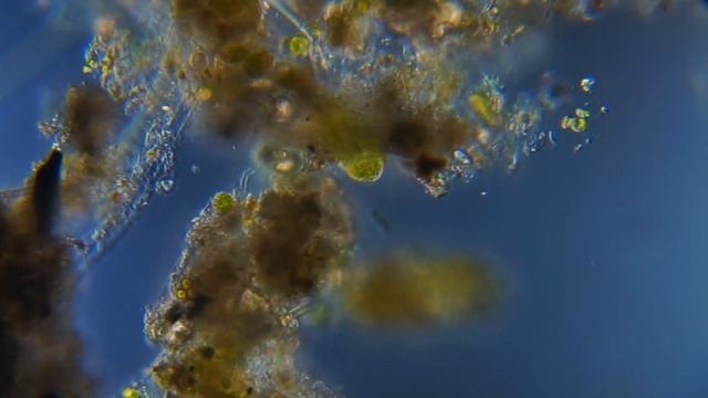 Инфузория под микроскопом