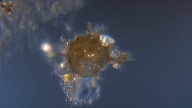 Панцирь амебы.