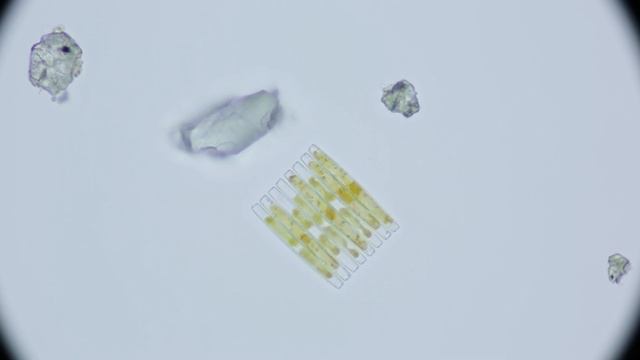 Antarctic Diatoms (80x) from McMurdo Sound Seafloor #2