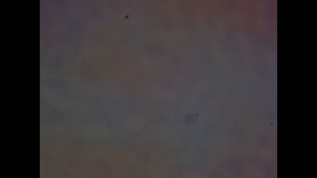 Кровь под микроскопом