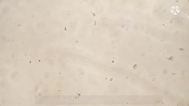 Zoom 1000x Air Waduk Rambutan Berparacetamol Di Mikroskop // Part-1