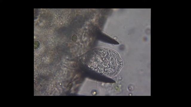 Vorticella reacts to high intensity UV.