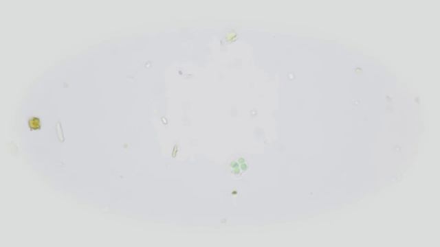 Antarctic Gloeocapsa Cyanobacteria (200x) from Dry Valleys Microbial Mat