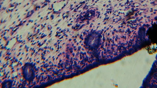 Human body tissues, onion skin, and some other slides under a Celestron LC II 44341