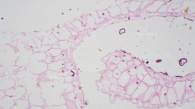 Matuer anther of Lilium in transversal section under microscope 100x on bright field