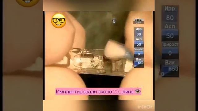 Отзыв о факичной коррекции
