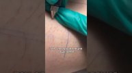 Электроэпиляция - это обязательно больно?