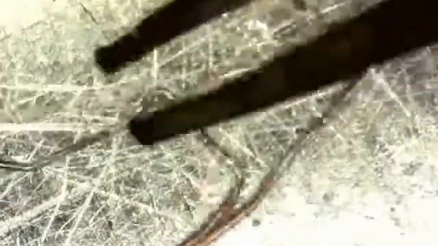 Petit coeur, camera microscope