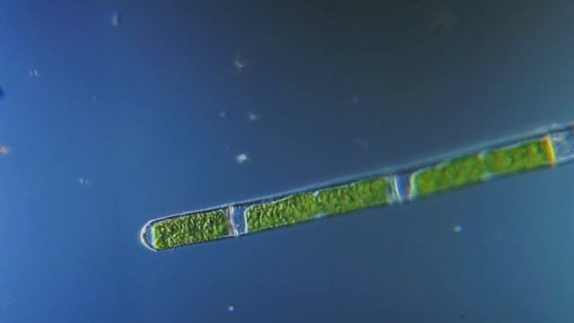 Нитчатая водоросль