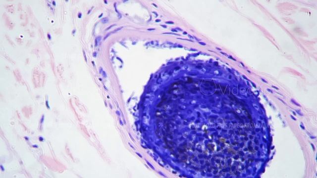 Skin of human shown with hair follicles in section filmed under microscope with 400x magnification