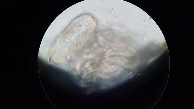 Parasit Camalanus sp