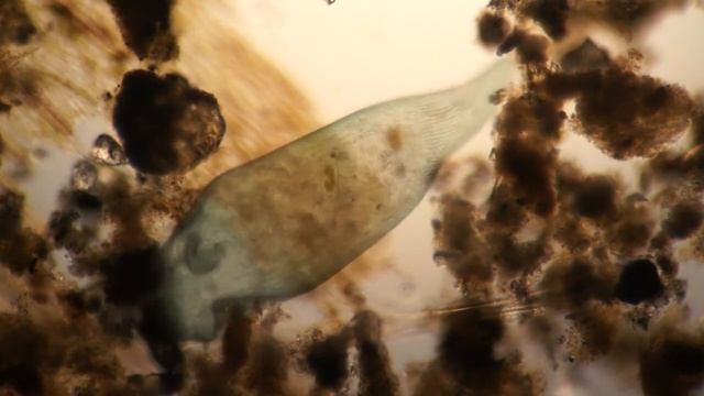 Stentor polymorphus