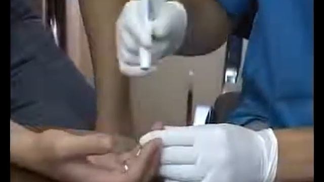 Гемотестирование по живой капле крови