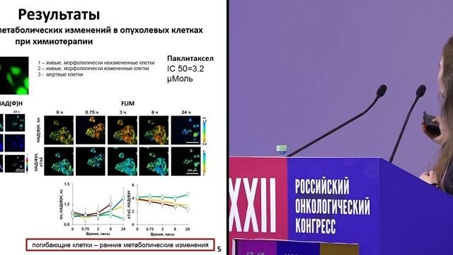 Исследование опухолевого метаболизма методом многофотонной микроскопии с временным разрешением