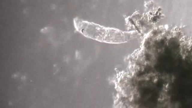 Under the Microscope  Friend’s Fish Tank water   HD 720p