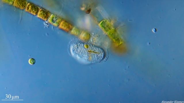 Amoeba Cochliopodium