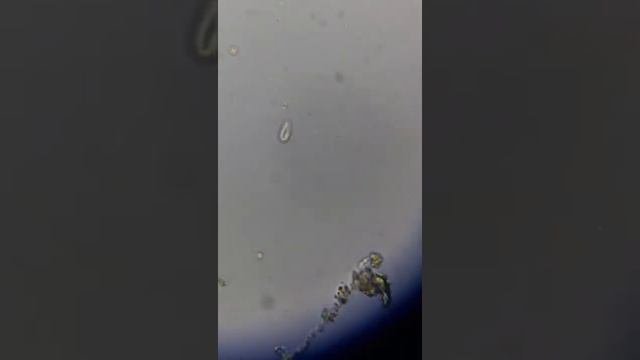 Microalgas Desde El Microscopio. 40X.