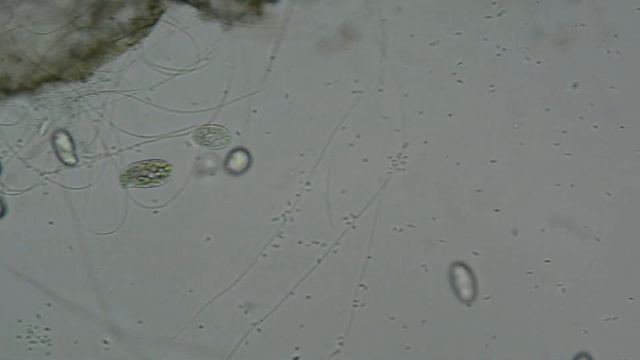 DSC 8627 Вода под микроскопом