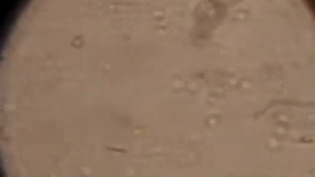 microfilaria