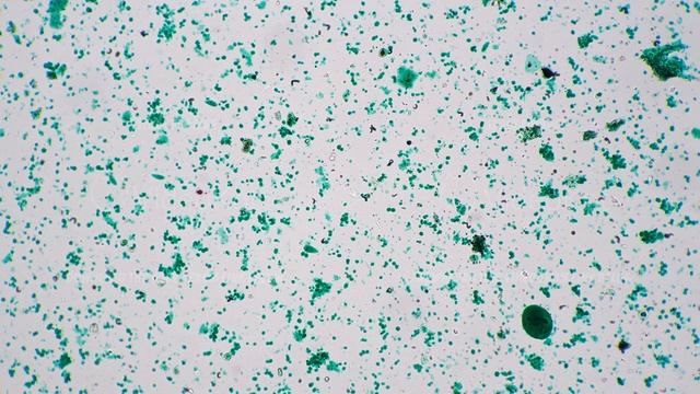 Chlamydomonas whole mount 100x under microscope against bright field