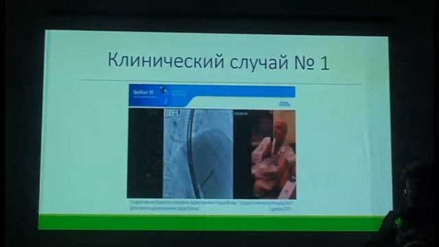 №4 Будзинский С А  возможности обследования желчных протоков, опыт SpyGlass