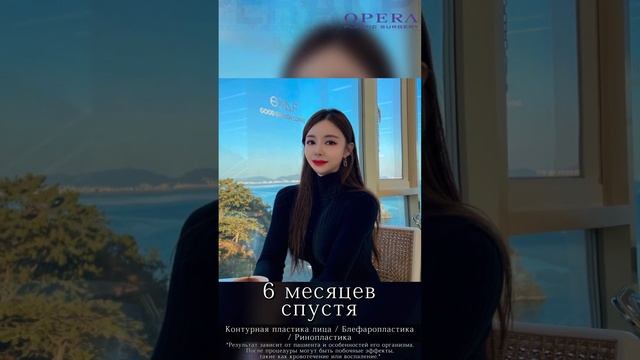 Ринопластика, блефаропластика и  челюстная пластика в клинике OPERA SURGERY PLASTIC