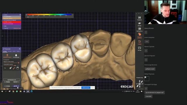 ExoCAD с чего начать и как использовать_