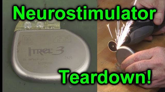 EEVblog #1027 -  Implantable NeuroStimulator Teardown