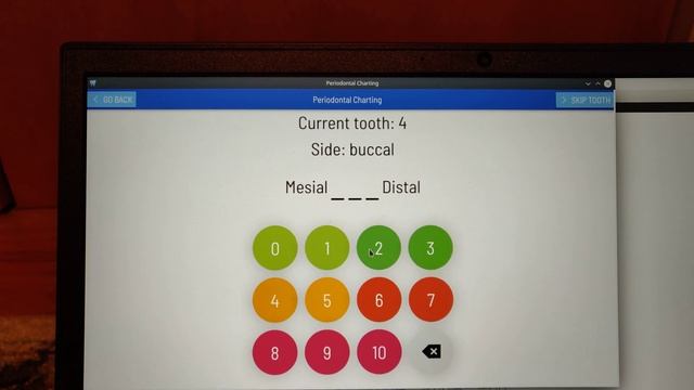 Clear.Dental with DeepSpeech periodontal probe testing